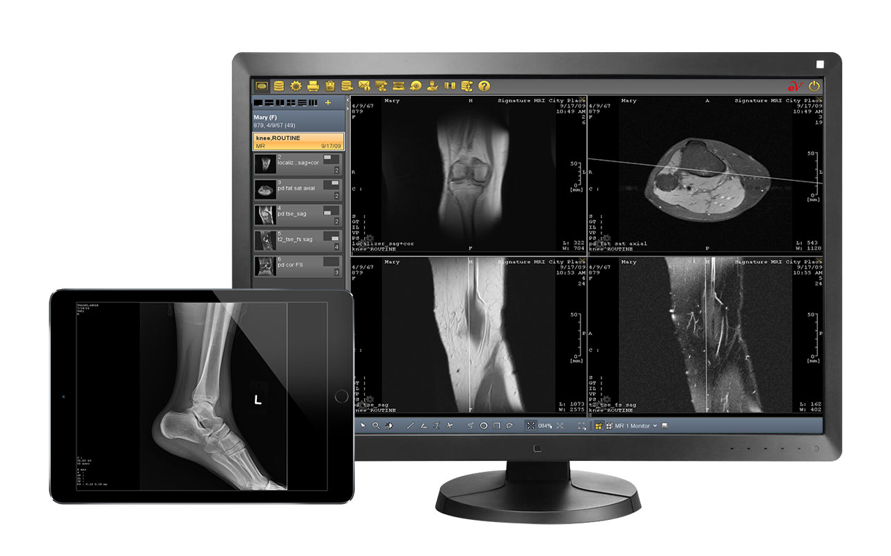 Picture Archiving and Communication Systems (PACS)