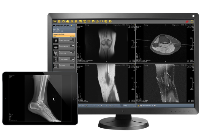 Picture Archiving and Communication Systems (PACS)